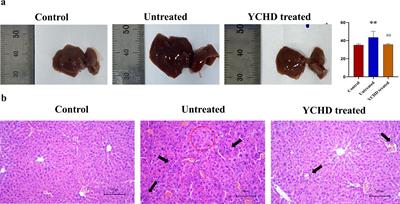 Protective effects of YCHD on the autoimmune hepatitis mice model induced by Ad-CYP2D6 through modulating the Th1/Treg ratio and intestinal flora